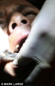 Dentist Pulled ALL Boyfriend’s Teeth After He Dumped Her For Another Woman